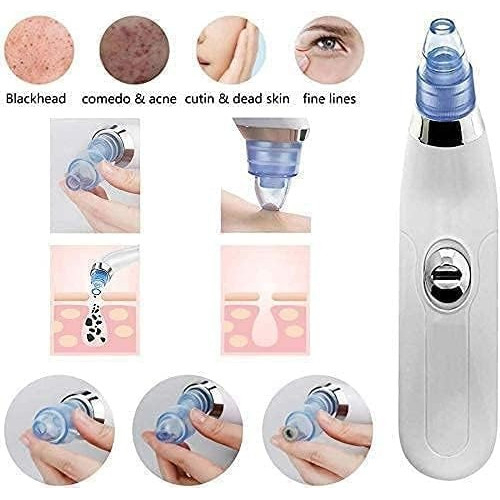 4 In 1 Multi-Function Blackhead Whitehead Extractor Remover Device