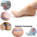 Silicone Gel Heel Pad Socks for Pain Relief – 2 Pair [ PACK OF 4 PCS ]